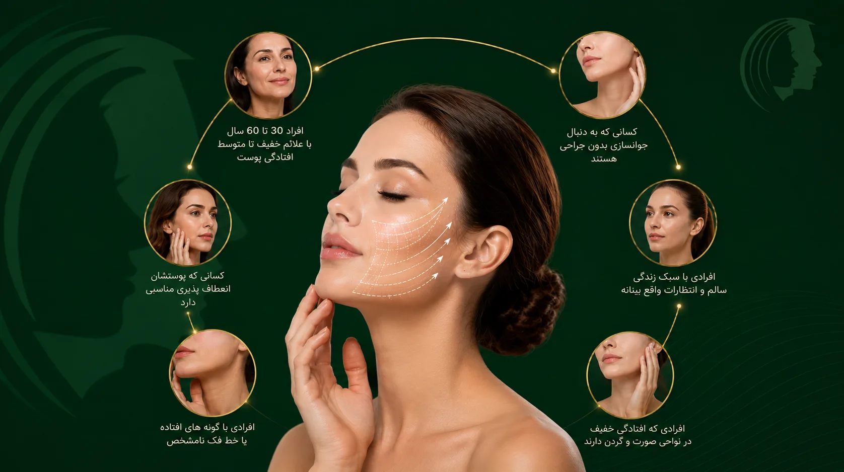 کاندید مناسب لیفت نخ در مشهد چه کسانی هستند؟